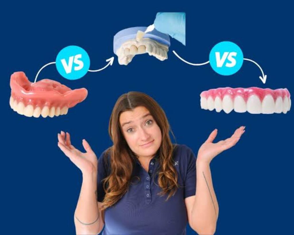 dentures vs veneers